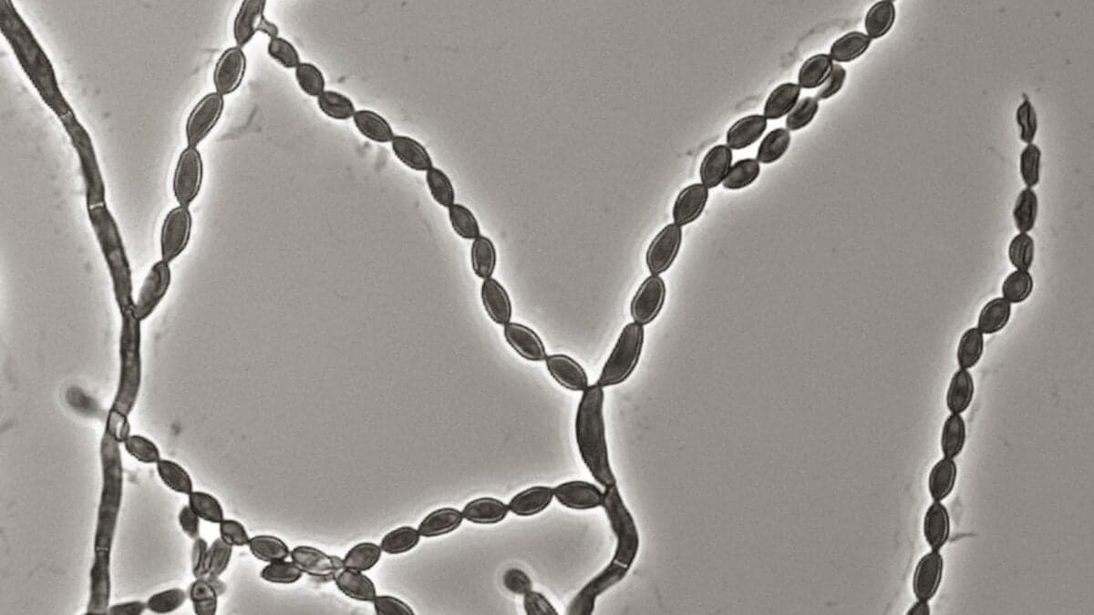 A Deadly Mold That Attacks the Brain Is on the Rise, and Scientists Aren’t Sure Why