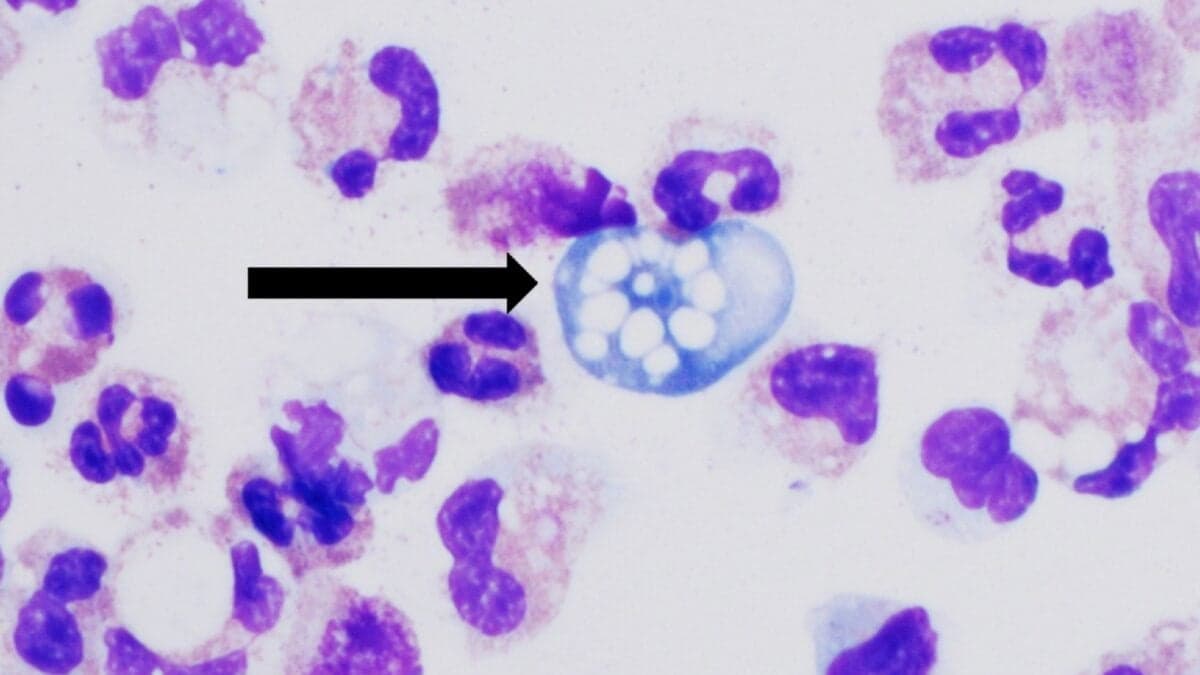 UC San Diego researchers identify rutamycin B as potential treatment for brain-eating amoeba