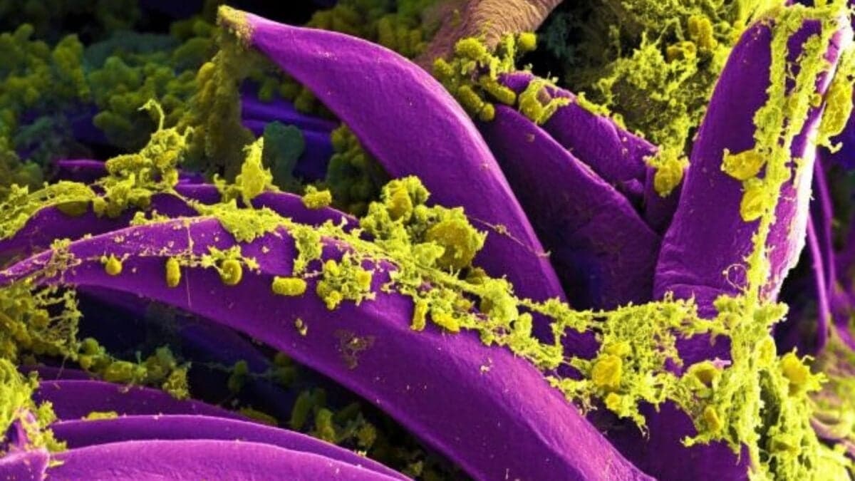 Death of Siberian Lab Worker Triggers Quarantines, No Pathogen Link Found