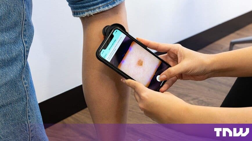 NHS South East rolls out skin cancer AI that can discharge patients alone