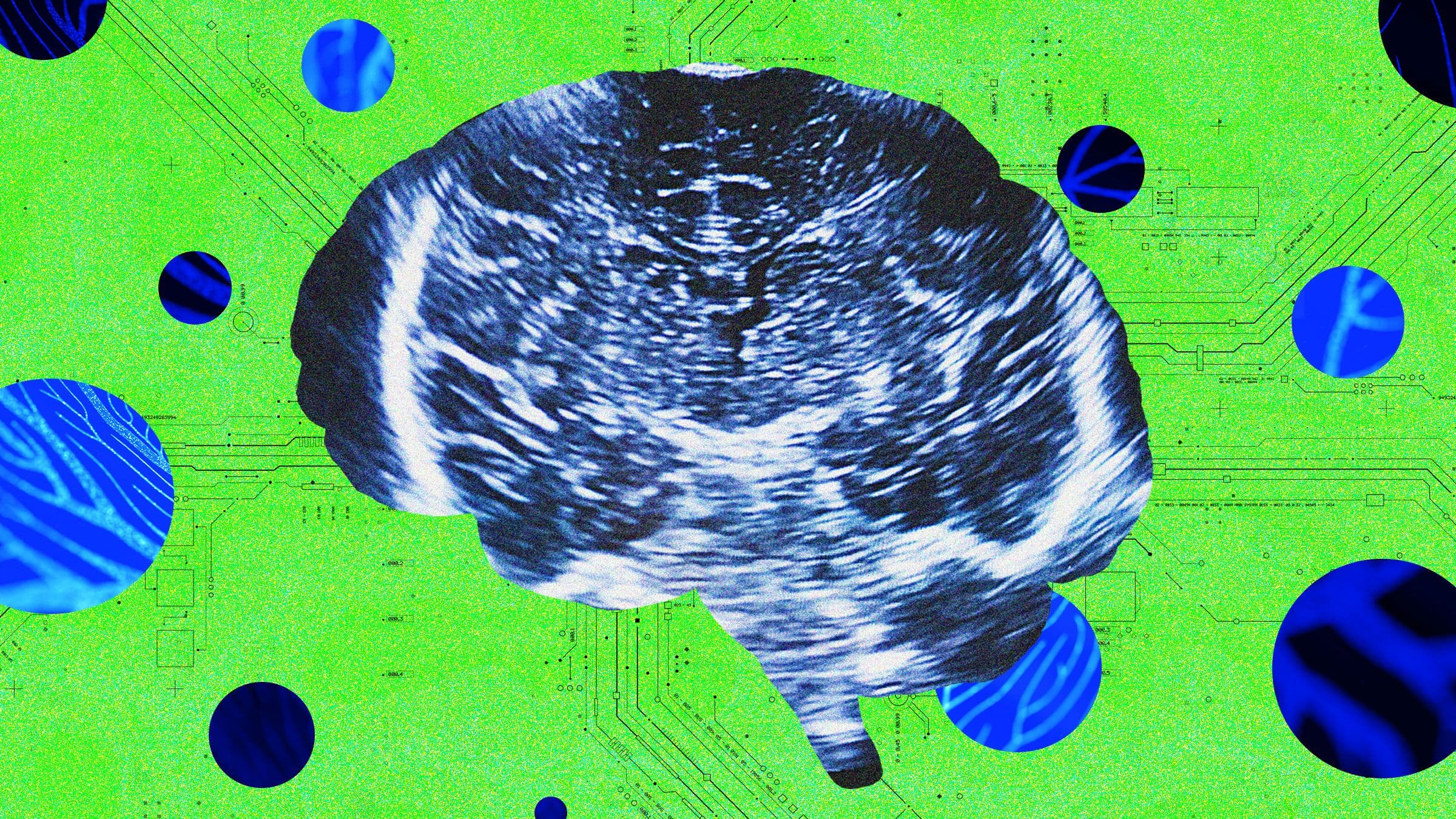 Bridge Neurotech Launches Wearable Ultrasound Brain-Computer Interface