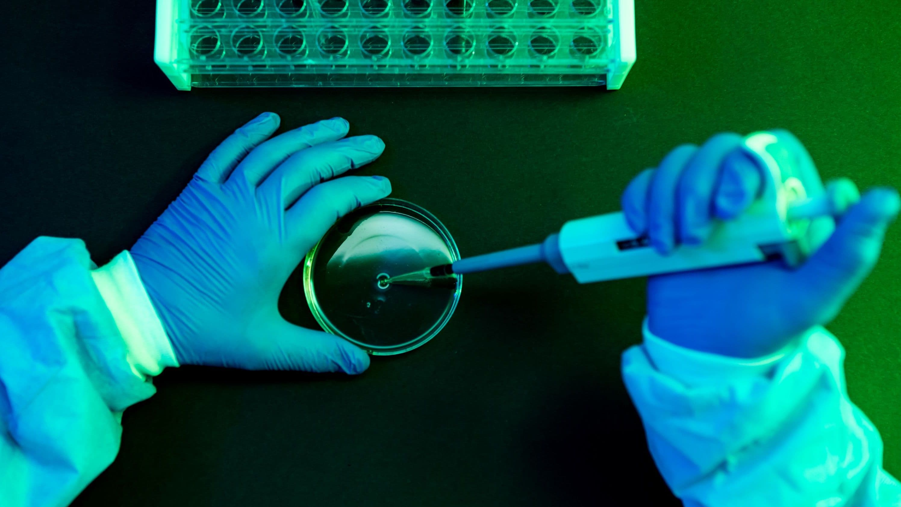 First human death linked to Shamonda virus reported in France